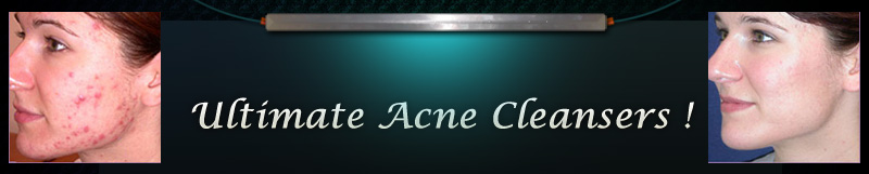 Acne Cleanser Header